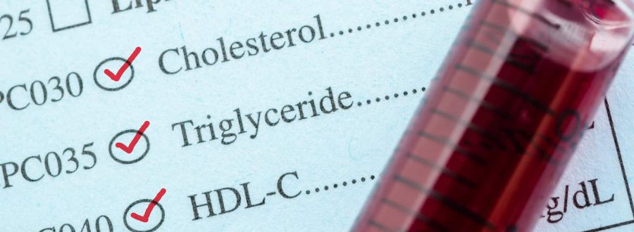 Co To Jest Cholesterol HDL Oraz Jego Normy Niski I Wysoki Cholesterol