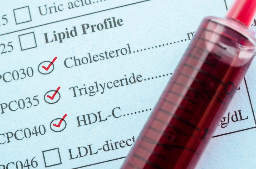 Co to jest cholesterol HDL oraz jego normy. Niski i wysoki cholesterol